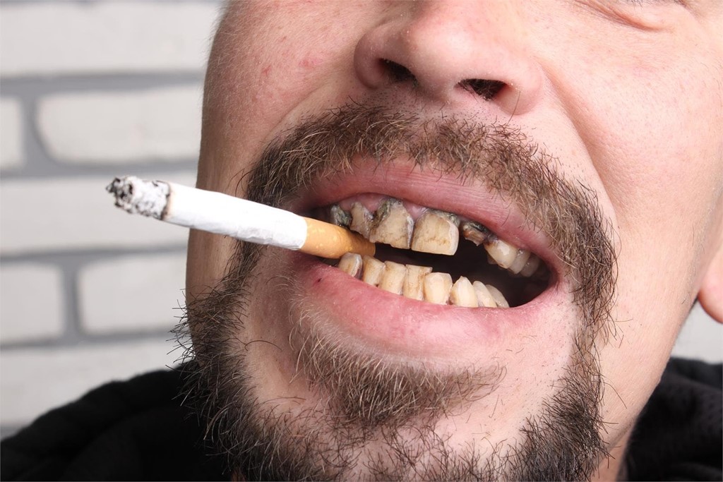 El impacto del tabaquismo en la salud dental