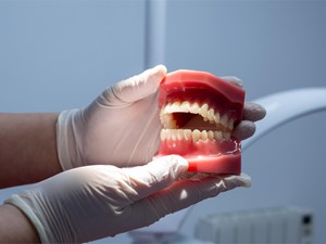 ¿Cómo influyen las prótesis dentales en tu salud y autoestima?
