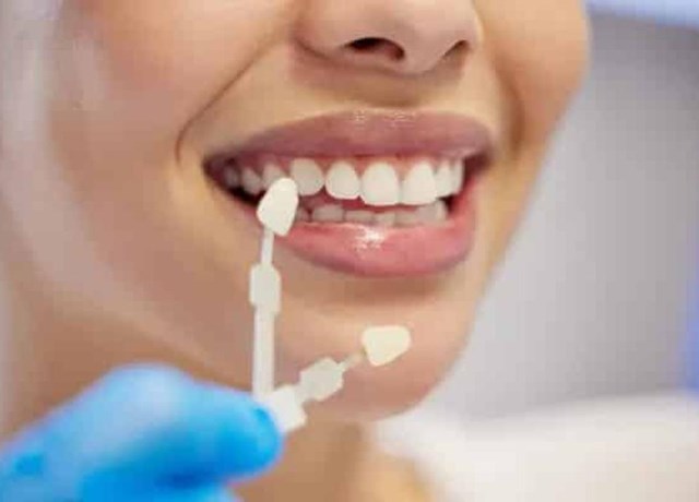 ¿Cómo mejorar la forma y el tamaño de tus dientes?