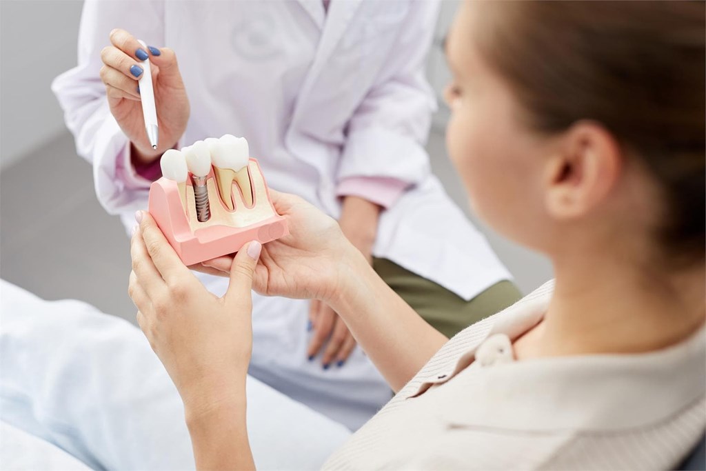 ¿Cuál es la vida útil de un implante dental? 3 Consejos para cuidarlos