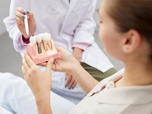 ¿Cuál es la vida útil de un implante dental? 3 Consejos para cuidarlos