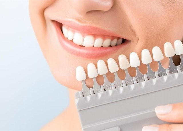 Especialistas en tratamientos de estética dental 