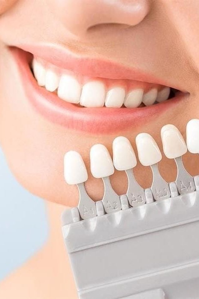 Especialistas en tratamientos de estética dental 