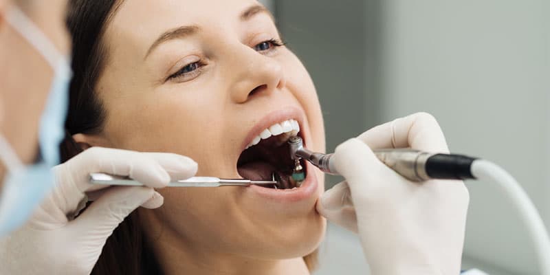 Endodoncias en clínica dental en Lugo