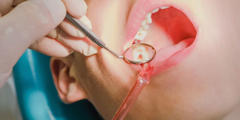 Especialistas en endodoncias en Lugo