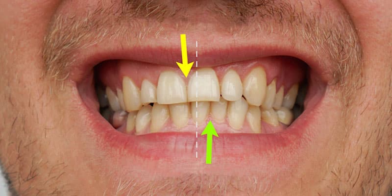 Corregir la asimetría dental en Lugo