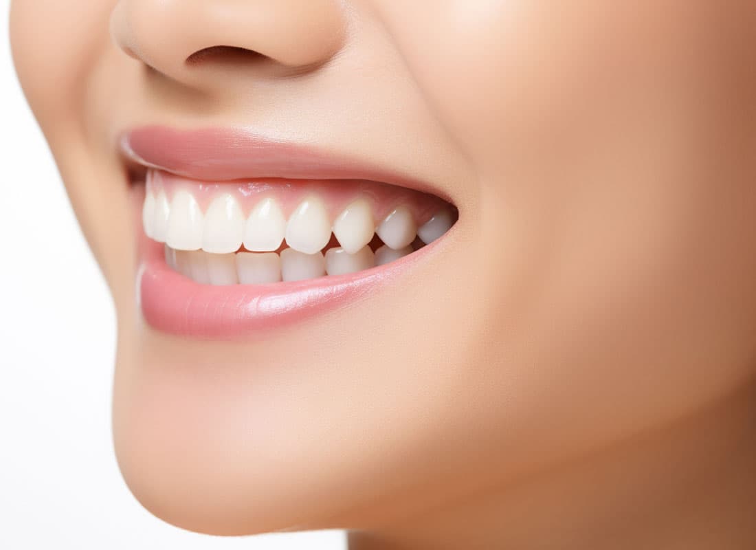 Implantes dentales en Lugo