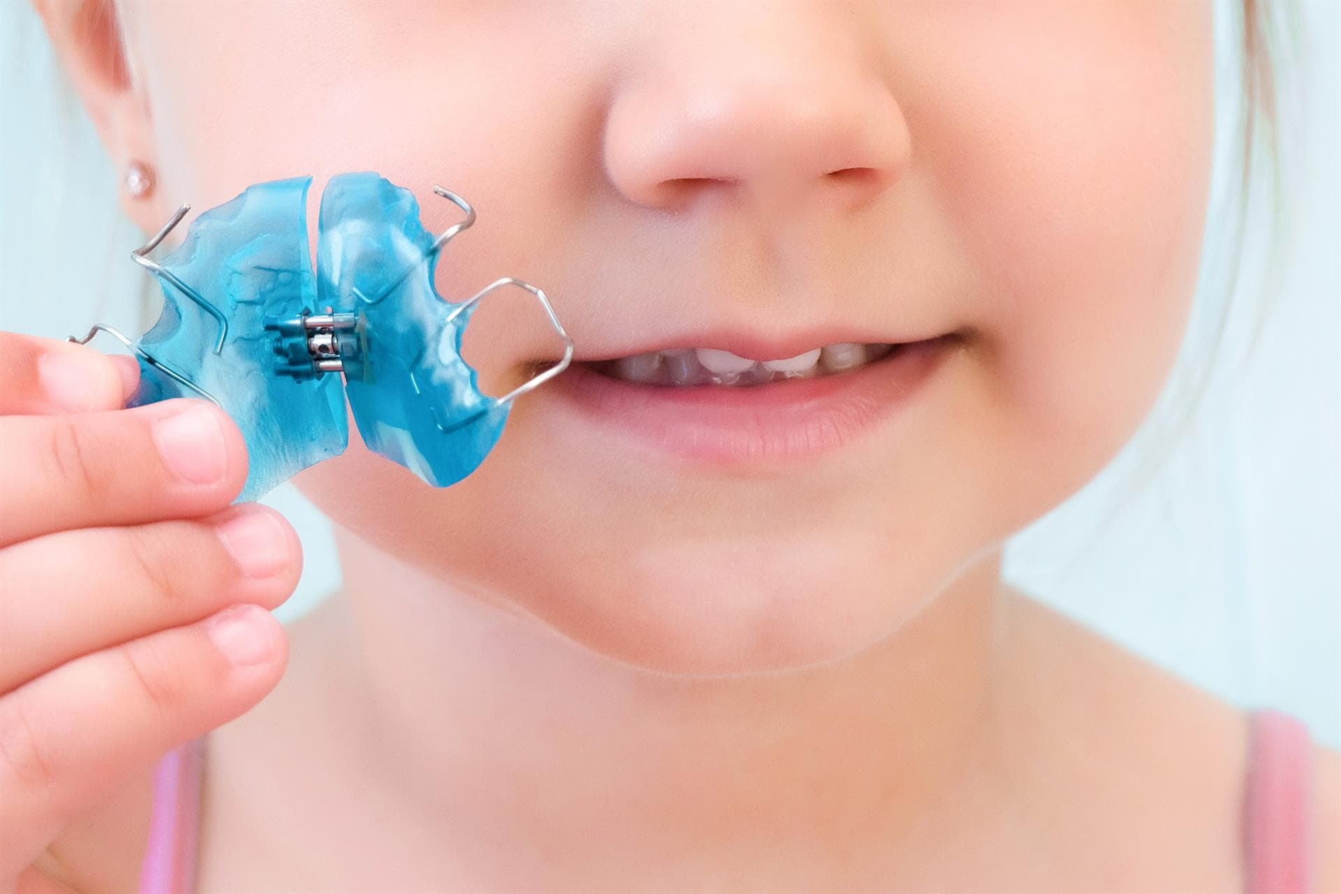 Ortodoncia infantil para corregir la mordida