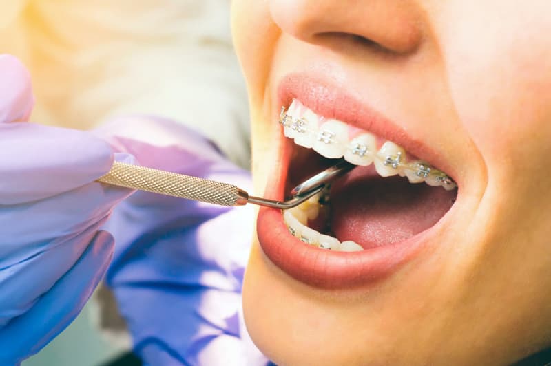 Ortodoncia en Lugo