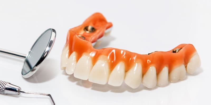 Prótesis dental fija en Lugo