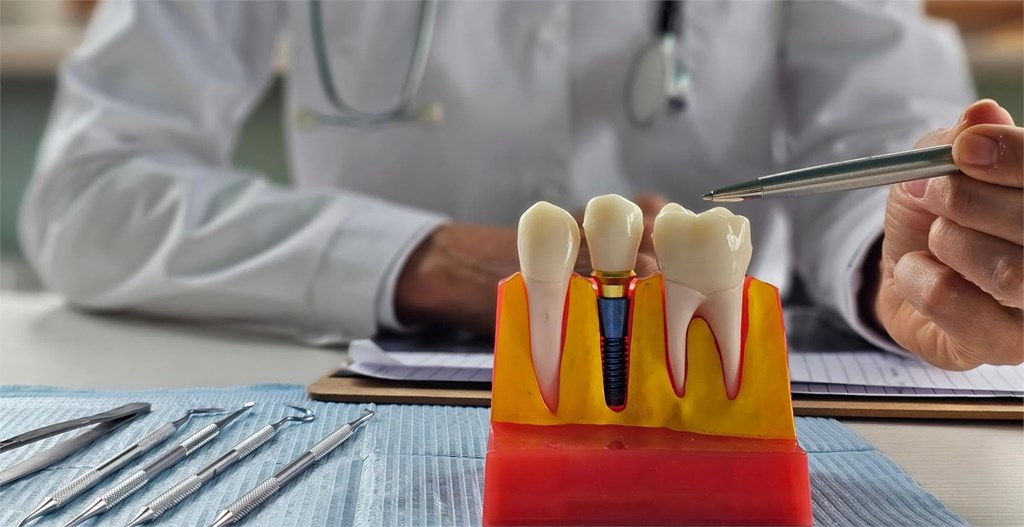 Mejora tu calidad de vida: los implantes dentales te devuelven la seguridad al comer y sonreír